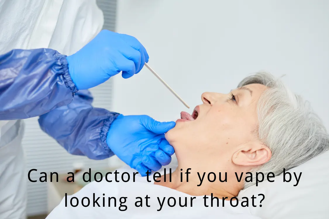 Can a doctor tell if you vape by looking at your throat SKE